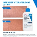 cerave-intensief-hydraterende-qntlPjuG-0.webp