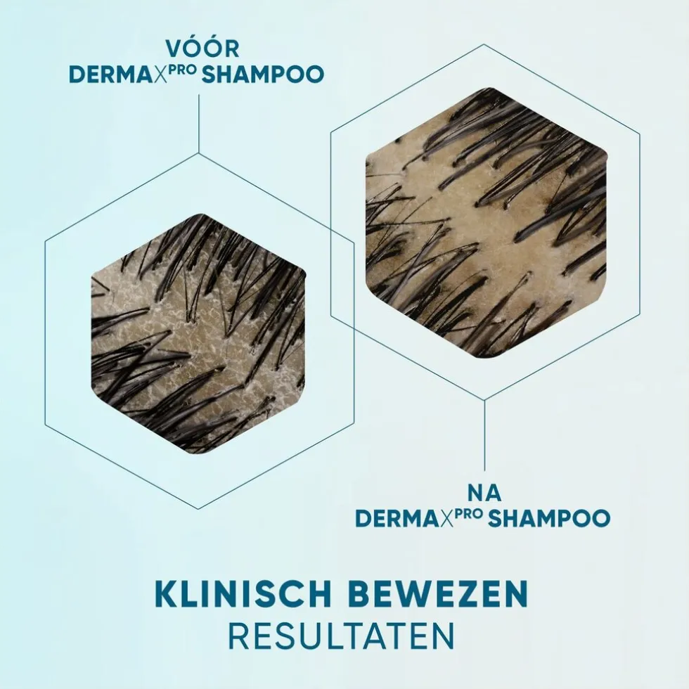 dermaxpro-by-head-shoulders-r-zcilPHTe-4.webp Hot Head & Shoulders DermaXPro By Revitaliseert Antiroosshampoo
