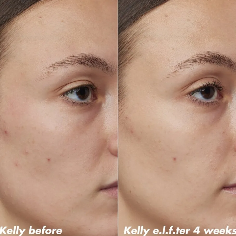 elf-skin-plz-clarify-facial-oi-GVNrSVkL-3.webp Sale ELF E.l.f. Skin PLZ Clarify Facial Oil