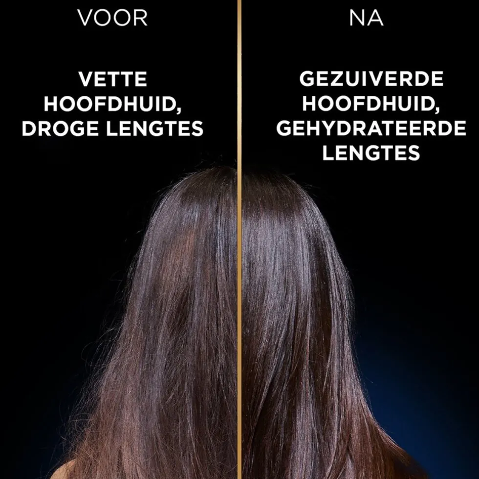 garnier-loving-blends-magnetic-yQMqGExV-2.webp Fashion Loving Blends Garnier Magnetic Charcoal Conditioner