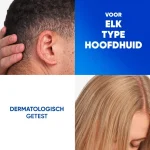 head-shoulders-jeukende-hoofd-yjXWhitE-0.webp