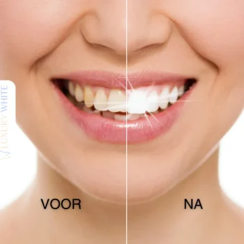 Outlet Luxury White Ultimate Whitening+