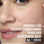 neutrogena-anti-puistjes-7-aha-mmNZQIAD-0.webp