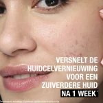 neutrogena-anti-puistjes-wasge-NsODerKn-0.webp
