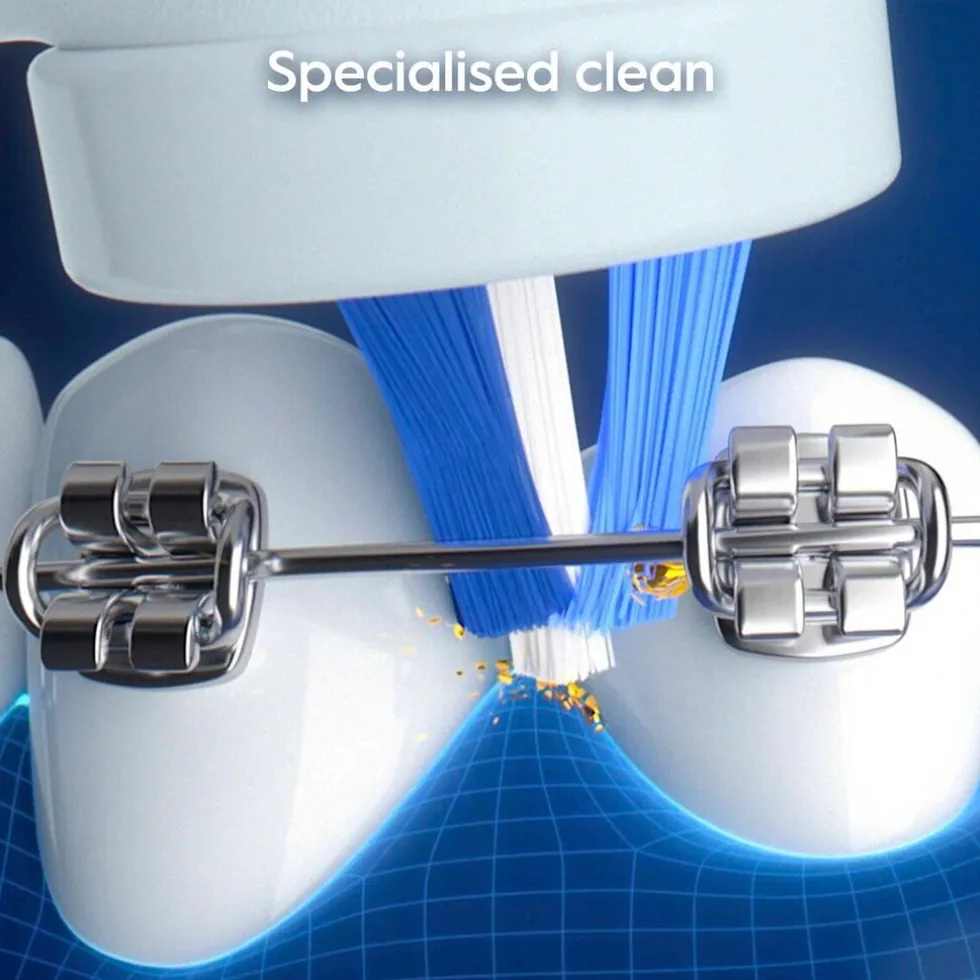 oral-b-io-my-way-teens-elektri-jMHGUCbI-4.webp Discount Oral B Oral-B IO My Way Teens Elektrische Tandenborstel