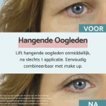 remescar-hangende-oogleden-oog-kvczNbKS-0.webp