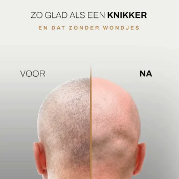 Sale Sansbeauté Hoofdscheerapparaat - Skull Shaver - Skullsharp PRO