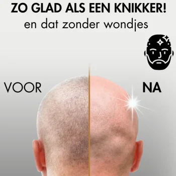 Hot Sansbeauté Hoofdscheerapparaat + Extra Scheerkop - Skull Shaver - Pro Magnetic